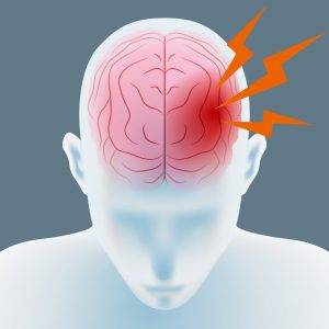 Арахноидальная киста головного мозга, виды и причины, симптомы и лечение