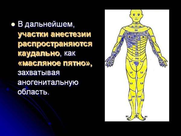 Опухоль спинного мозга, симптомы рака и диагностика онкологии, прогноз, сколько живут