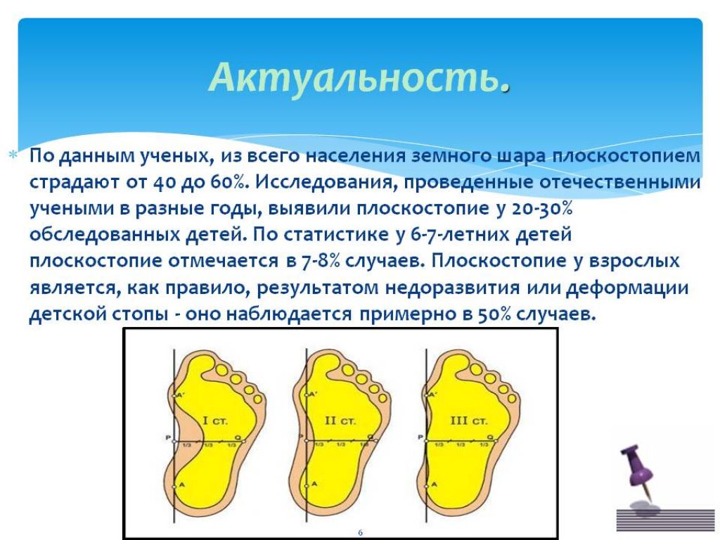 Плоскостопие биология. Развитие плоскостопия. Актуальность плоскостопия. Понятие о плоскостопии. Плоскостопия детей актуальность.