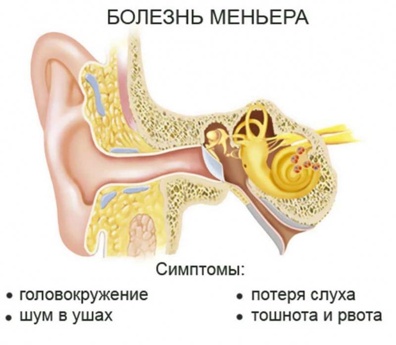 Причины, по которым закладывает уши и кружится голова
