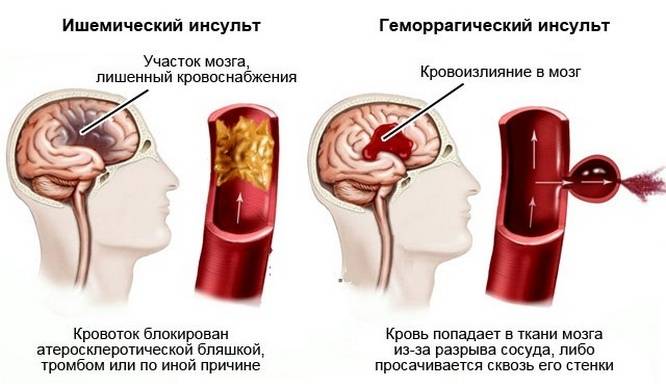 Допплерография уздг, узи, дуплексное сканирование сосудов: описание методов