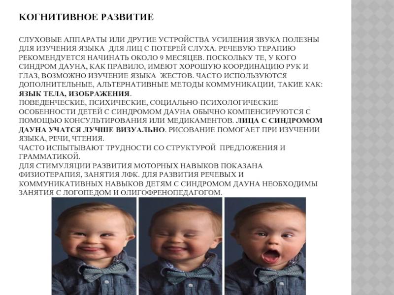 Признаки дауна у новорожденного ребенка с фото