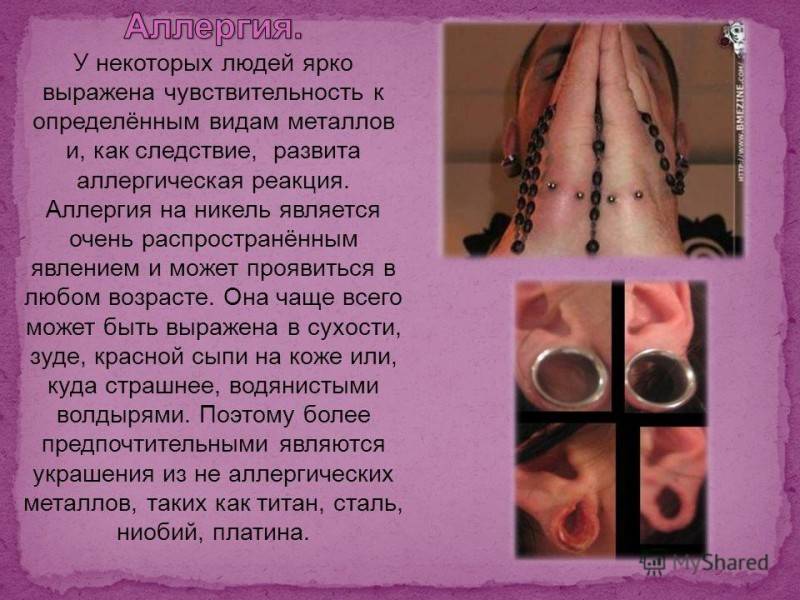 Позорно и престижно
