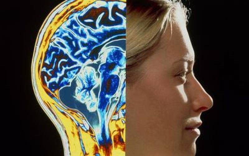 Диагностика МРТ сосудов головного мозга