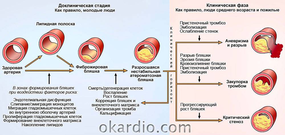 Дэп 2 стадии на фоне церебрального атеросклероза