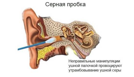 Причины, по которым закладывает уши и кружится голова