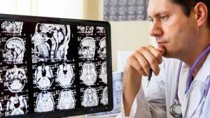 Рентген и КТ головы при головных болях: проведение процедуры, ее преимущества и недостатки