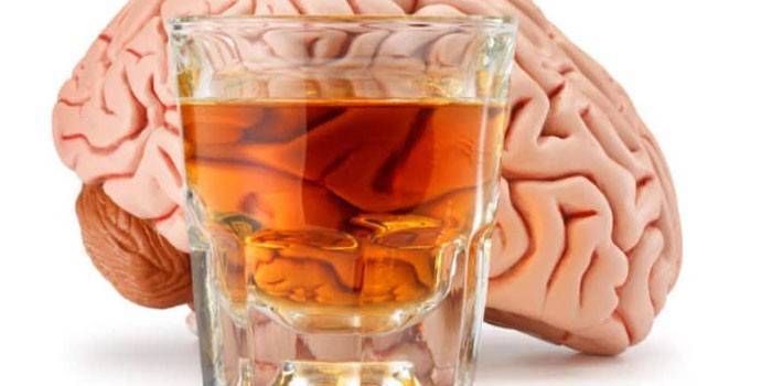 Ученые: алкоголь разрушает мозг после отказа от употребления