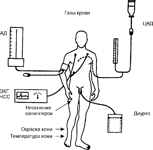 Что значит быть в агонии. агональное состояние