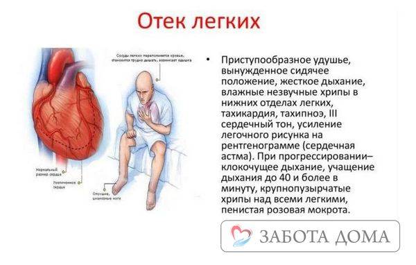 Клиническая патофизиология отека головного мозга