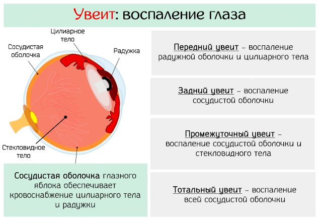 После рабочего дня болят глаза