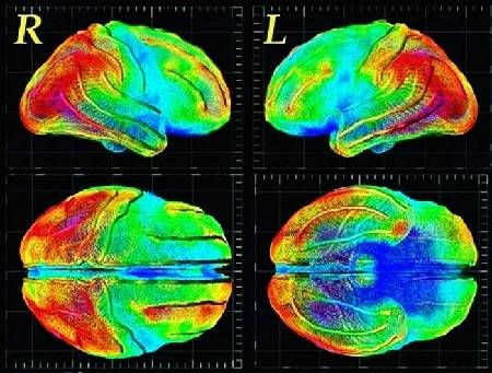 Кт томография головного мозга ребенку