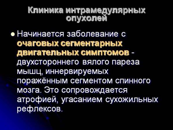 Опухоль спинного мозга, симптомы рака и диагностика онкологии, прогноз, сколько живут