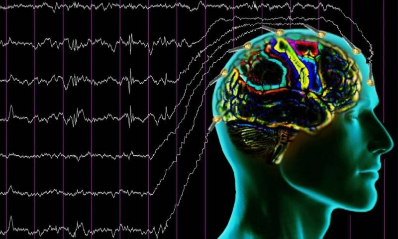 Диффузные изменения биоэлектрической активности головного мозга