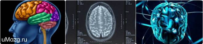 Субдуральная гематома головного мозга: лечение и последствия