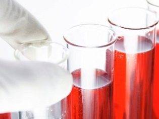 Синдром угнетения у новорожденных: причины, диагностика и лечение, последствия