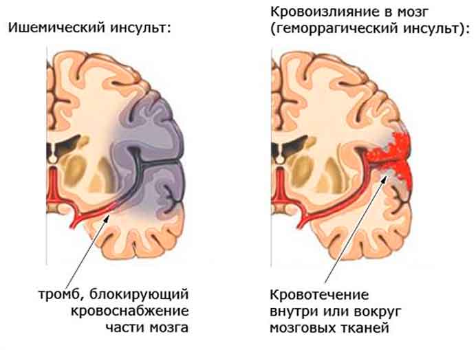 Уздг сосудов головы и шеи фото