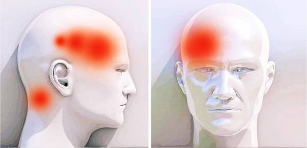 Регулярные головные боли причины