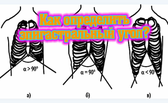 Телосложение типы у женщин. фото, как определить: эктоморф, мезоморф, эндоморф, астеник, нормостеник, гиперстеник